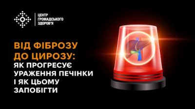 Від фіброзу до цирозу: як прогресує ураження печінки і як цьому запобігти